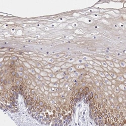 alpha-2C Adrenergic R/ADRA2C Antibody, Novus Biologicals:Antibodies:Primary